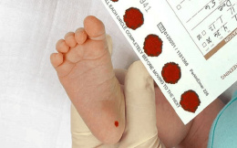 Новорожденных лобненцев будут проверять на 36 генетических маркеров