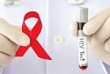 Жителям Лобни предлагают пройти обследование на ВИЧ